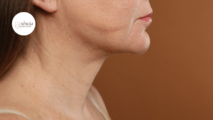 Flacidez da pele: por que ela acontece e quais cuidados ajudam a preservar a firmeza?