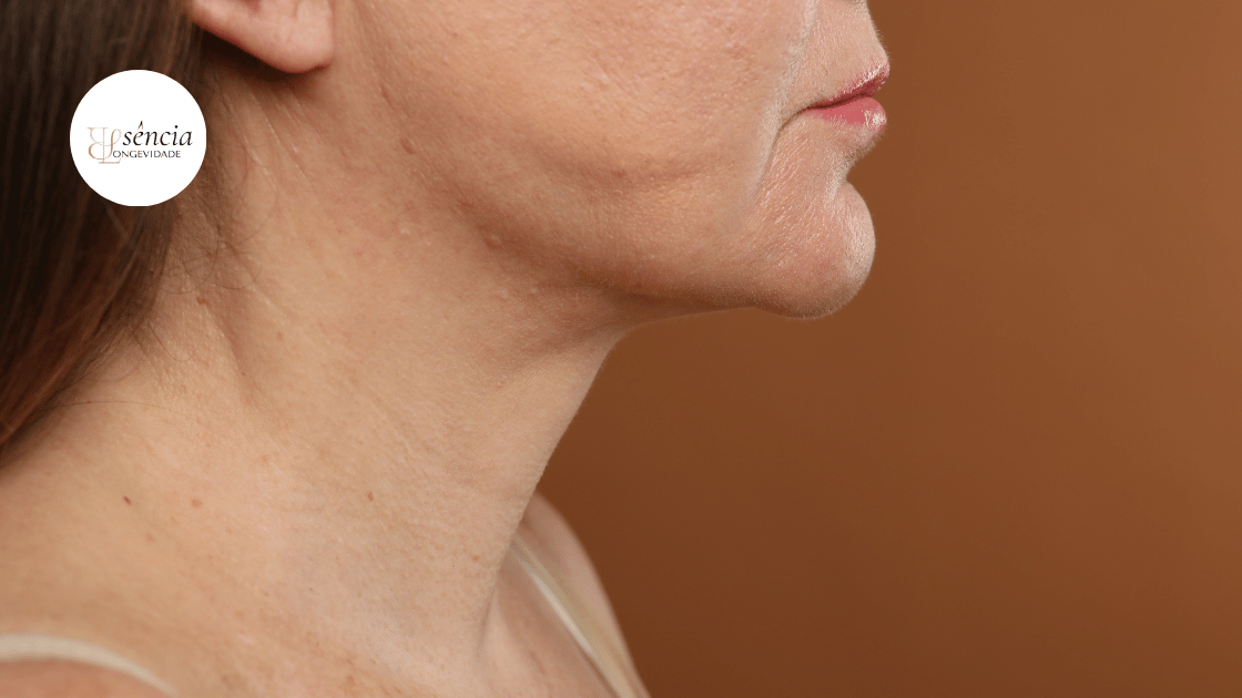 Flacidez da pele: por que ela acontece e quais cuidados ajudam a preservar a firmeza?