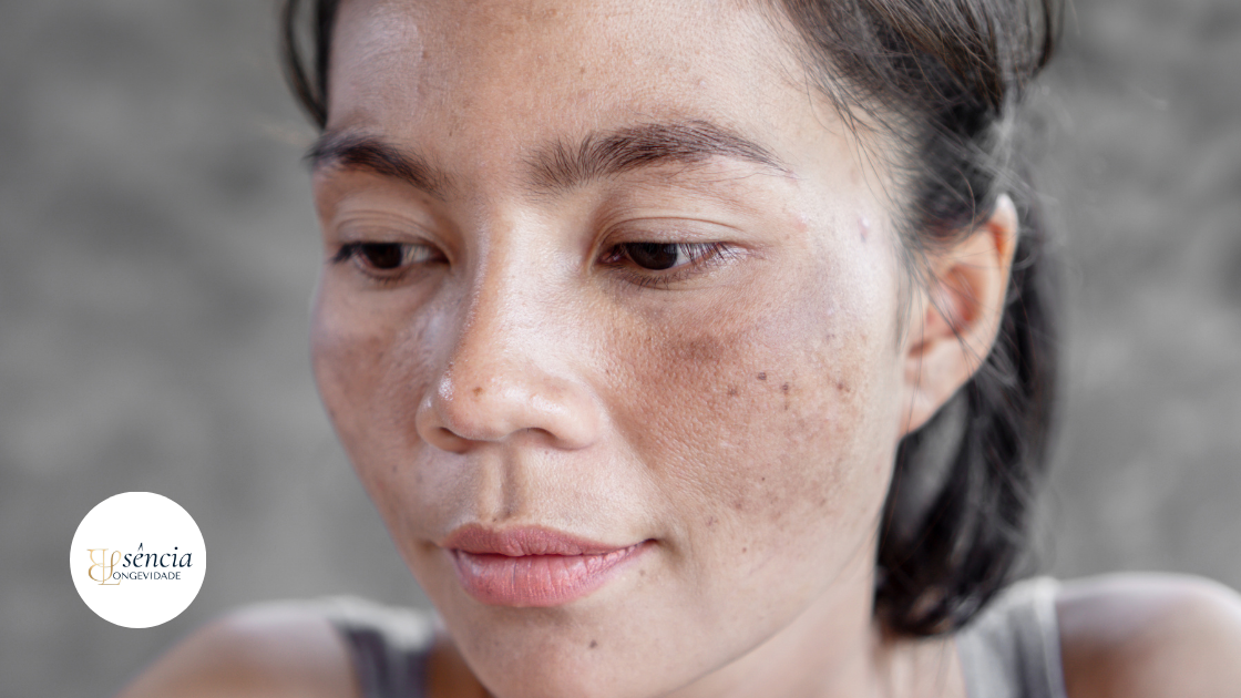 Gerenciamento de Manchas e Melasma: O Guia Definitivo Baseado na Ciência e no Autocuidado Consciente